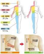 帶狀皰疹癥狀表現(xiàn)是什么樣的？